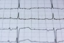 interstellar energy flow dynamics